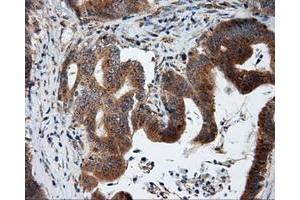 Immunohistochemical staining of paraffin-embedded liver tissue using anti-KIAA1609 mouse monoclonal antibody. (KIAA1609 antibody)