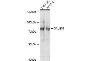 Western blot analysis of extracts of various cell lines, using G antibody (ABIN7271209) at 1:1000 dilution. (GALNT6 antibody  (AA 30-140))