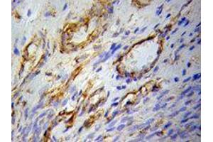Immunohistochemistry (IHC) image for anti-Peroxisome Proliferator-Activated Receptor gamma (PPARG) (AA 50-150) antibody (ABIN3020844)