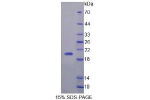 SDS-PAGE analysis of Human NT5C Protein.