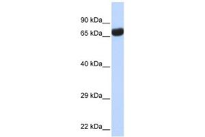 TPTE antibody used at 1 ug/ml to detect target protein. (TPTE antibody  (Middle Region))
