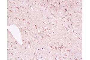 Formalin-fixed and paraffin embedded rat brain labeled with Rabbit Anti-Tyrosine Hydroxylase(Neuronal Marker)/Tyk2/TYH Polyclonal Antibody, Unconjugated  1:200 followed by conjugation to the secondary antibody and DAB staining (Tyrosine Hydroxylase antibody  (AA 101-165))