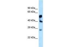 Image no. 1 for anti-Lysophosphatidylglycerol Acyltransferase 1 (LPGAT1) (AA 230-279) antibody (ABIN6747957) (LPGAT1 antibody  (AA 230-279))