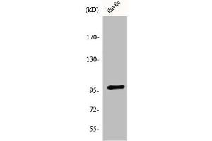 Western Blot analysis of HeLa cells using MRTF-A Polyclonal Antibody (MKL1 antibody  (N-Term))