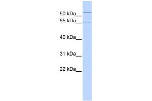 WB Suggested Anti-ZNF30 Antibody Titration:  0. (ZFP30 antibody  (Middle Region))
