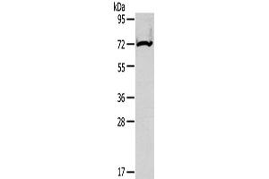 Western Blotting (WB) image for anti-Carnitine Palmitoyltransferase 2 (CPT2) antibody (ABIN2425697) (CPT2 antibody)