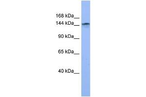 WB Suggested Anti-COL4A3 Antibody Titration: 0.