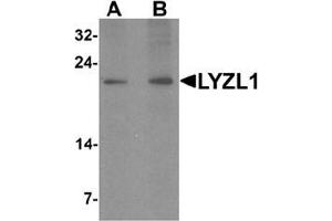 Western blot analysis of LYZL1 in A20 cell lysate with LYZL1 Antibody  at (A) 1 and (B) 2 ug/mL. (Lysozyme-Like 1 antibody  (N-Term))