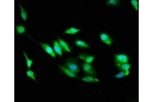 Immunofluorescence staining of Hela cells with ABIN7168982 at 1:100, counter-stained with DAPI. (STK24 antibody  (AA 1-431))