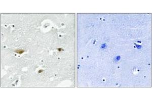 Immunohistochemistry analysis of paraffin-embedded human brain, using STK39 (Phospho-Ser325) Antibody. (STK39 antibody  (pSer325))