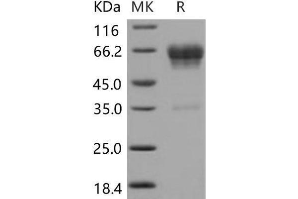 CD99L2 Protein (Fc Tag)