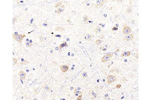 Immunohistochemistry analysis of paraffin-embedded mouse spinal marrow using NTRK2 Polyclonal Antibody at dilution of 1:400. (TRKB antibody)