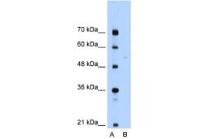 SLA/LP antibody used at 1 ug/ml to detect target protein. (SEPSECS antibody  (N-Term))