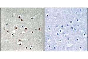 Immunohistochemistry (IHC) image for anti-Myocyte Enhancer Factor 2C (MEF2C) (AA 362-411), (pSer396) antibody (ABIN1532153)