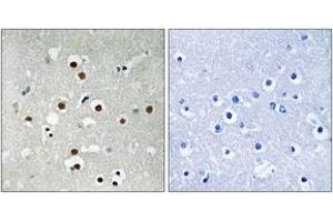 Immunohistochemistry analysis of paraffin-embedded human brain, using MEF2C (Phospho-Ser396) Antibody.