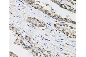 Immunohistochemistry of paraffin-embedded Human prostate using TCEB1 Polyclonal Antibody (TCEB1 antibody)