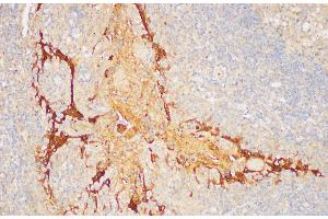 Immunohistochemistry of paraffin-embedded Human tonsil using SERPINB2 Polycloanl Antibody at dilution of 1:200 (SERPINB2 antibody)