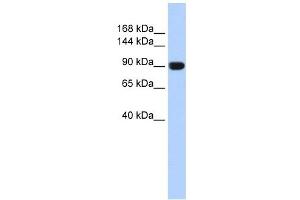 TMEM16A antibody used at 1 ug/ml to detect target protein.