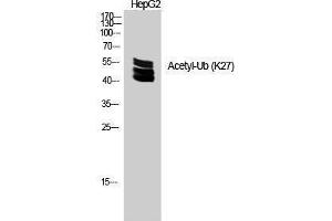 Western Blotting (WB) image for anti-Ubiquitin (Ubiquitin) (acLys27) antibody (ABIN3181496) (Ubiquitin antibody  (acLys27))
