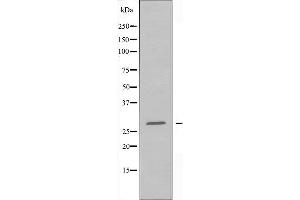 Western blot analysis of extracts from HepG2 cells using 14-3-3 β antibody. (YWHAB antibody  (C-Term))