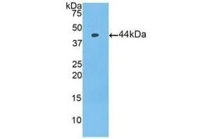 Detection of Recombinant PIP, Mouse using Polyclonal Antibody to Prolactin Induced Protein (PIP) (PIP antibody  (AA 1-146))