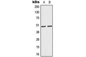 Western blot analysis of Caspase 9 expression in HeLa (A), Jurkat (B) whole cell lysates.