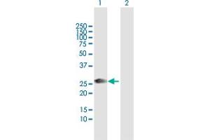 Western Blot analysis of ORC6L expression in transfected 293T cell line by ORC6L MaxPab polyclonal antibody. (ORC6 antibody  (AA 1-252))