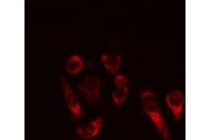 ABIN6269334 staining MCF-7 cells by IF/ICC. (BCL2L1 antibody  (N-Term))