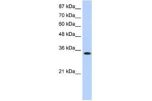 MBNL1 antibody used at 0. (MBNL1 antibody)