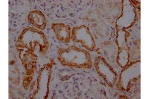 IHC image of ABIN7127849 diluted at 1:100 and staining in paraffin-embedded human kidney tissue performed on a Leica BondTM system. (Recombinant TOMM22 antibody)