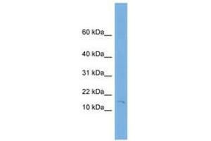 Image no. 1 for anti-Fragile Histidine Triad (FHIT) (C-Term) antibody (ABIN6744905) (FHIT antibody  (C-Term))