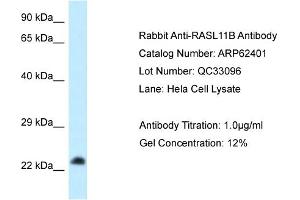 Western Blotting (WB) image for anti-RAS-Like, Family 11, Member B (RASL11B) (C-Term) antibody (ABIN2789131) (RASL11B antibody  (C-Term))