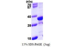 SDS-PAGE (SDS) image for Tropomyosin 4 (TPM4) (AA 1-248) protein (His tag) (ABIN667406)