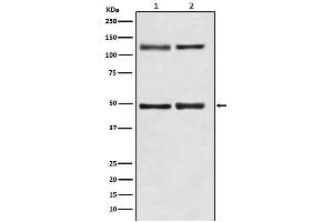 All Lanes: NF-κB p105/p50 Antibody at 1/ 1000 dilution. (Recombinant NFkB antibody)