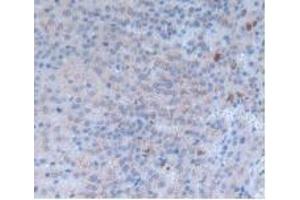 Detection of INHbA in Rat Adrenal Gland Tissue using Monoclonal Antibody to Inhibin Beta A (INHbA) (INHBA antibody  (AA 314-424))