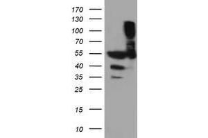 HEK293T cells were transfected with the pCMV6-ENTRY control (Left lane) or pCMV6-ENTRY TUBAL3 (Right lane) cDNA for 48 hrs and lysed. (TUBAL3 antibody  (AA 150-446))