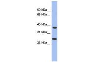 Image no. 1 for anti-Mitochondrial Translational Release Factor 1-Like (MTRF1L) (AA 35-84) antibody (ABIN6744041)