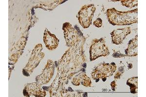 Immunostaining (ISt) image for anti-Ribosomal Protein S6 Kinase, 70kDa, Polypeptide 1 (RPS6KB1) (AA 416-525) antibody (ABIN562721)