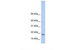 Image no. 1 for anti-MYC Associated Factor X (MAX) (N-Term) antibody (ABIN6737893) (MAX antibody  (N-Term))