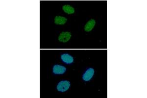 ICC/IF analysis of RuVBL in HeLa cells line, stained with DAPI (Blue) for nucleus staining and monoclonal anti-human RuVBL antibody (1:100) with goat anti-mouse IgG-Alexa fluor 488 conjugate (Green). (RUVBL1 antibody  (AA 1-456))