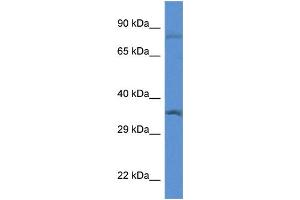WB Suggested Anti-Gtf2b Antibody Titration: 1. (GTF2B antibody  (N-Term))