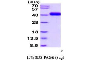 SDS-PAGE (SDS) image for Carnosine Dipeptidase 1 (Metallopeptidase M20 Family) (CNDP1) (AA 1-492) protein (His tag) (ABIN5854659)