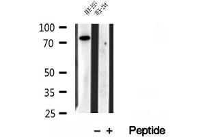 Western blot analysis of extracts of HEK-293 cells, using IFT81 antibody. (IFT81 antibody)
