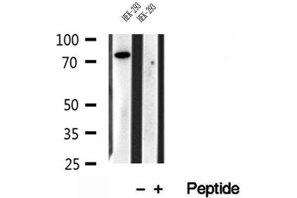 IFT81 antibody