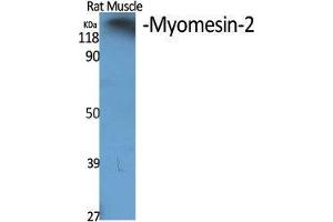 Western Blot (WB) analysis of specific cells using Myomesin-2 Polyclonal Antibody.