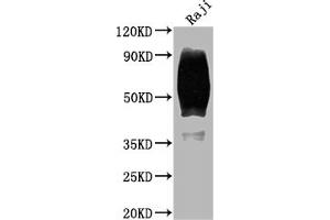 Western Blot Positive WB detected in: Raji whole cell lysate All lanes: CD80 antibody at 1:2000 Secondary Goat polyclonal to rabbit IgG at 1/50000 dilution Predicted band size: 34, 30, 19 kDa Observed band size: 60 kDa (Recombinant CD8 antibody)