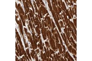 Immunohistochemical staining of human heart muscle with UBE3D polyclonal antibody  shows strong cytoplasmic positivity in myocytes at 1:20-1:50 dilution. (UBE3D antibody)