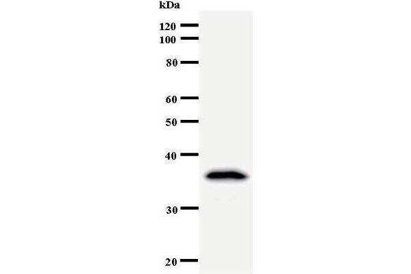 DDX39 antibody