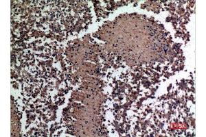 Immunohistochemistry (IHC) image for anti-HSPB (Heat Shock 27kDa) Associated Protein 1 (HSPBAP1) (Internal Region) antibody (ABIN6283284)