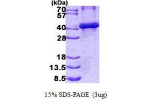 Image no. 1 for Biglycan (BGN) protein (His tag) (ABIN1098780)